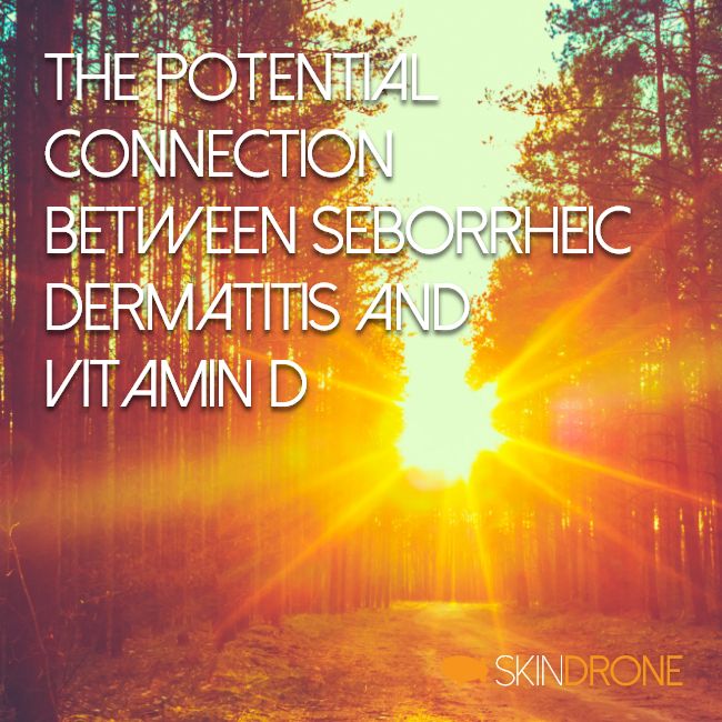 Connection Between Seborrheic Dermatitis and Vitamin D - Cover Photo - Sunshine