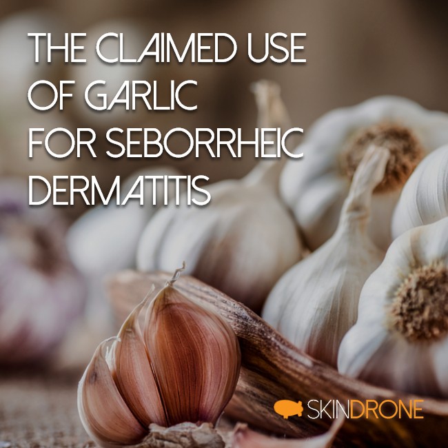 Cover image for article reviewed the claim that garlic can be used for treatment of seborrheic dermatitis - image shows bulbs of garlic on wooden plate beside several cloves with title overlay