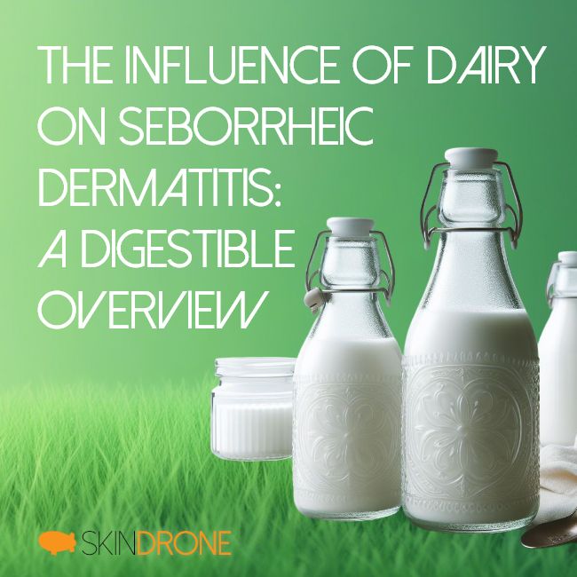 Banner image for article, three old fashioned bottles of milk on the right hand side and article title "The Influence of Dairy on Seborrheic Dermatitis: A Digestible Overview" on the left.